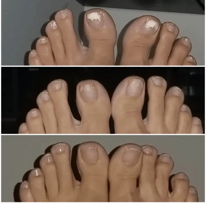 Fungabeam customer review Terry L.