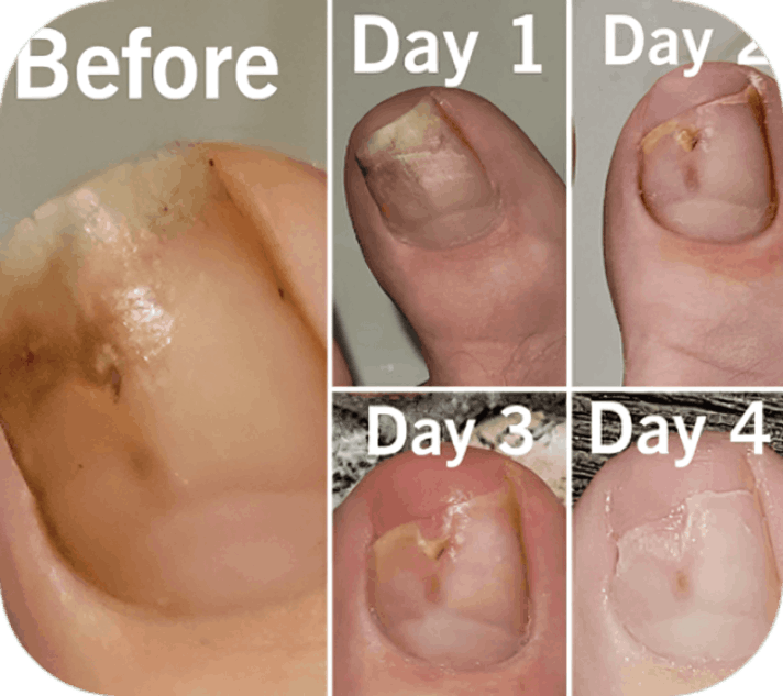 Fungabeam review Drew A.